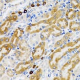 Immunohistochemistry - Anti-PGRMC1 Antibody (A14864) - Antibodies.com