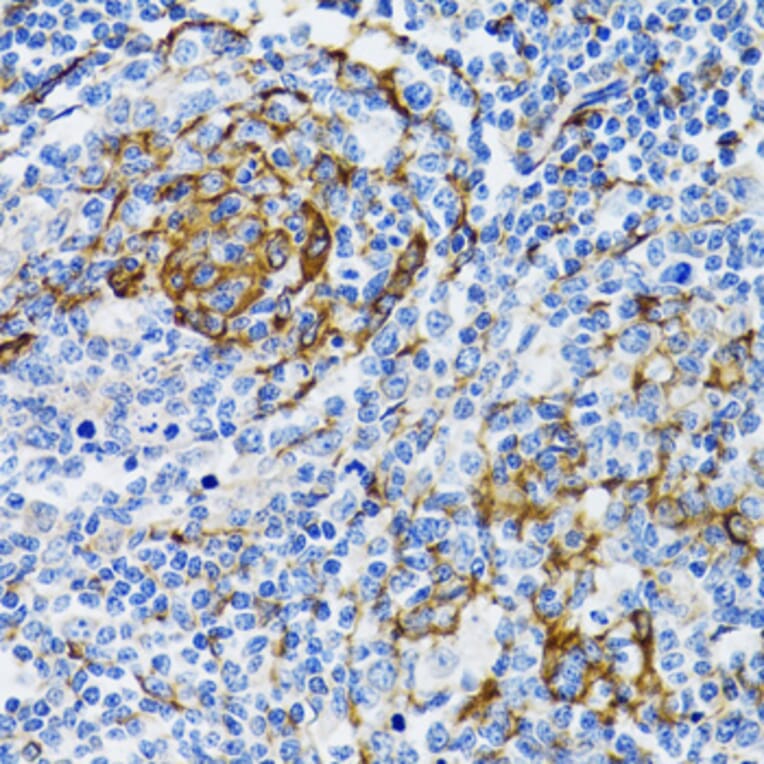 Immunohistochemistry - Anti-PGRMC1 Antibody (A14864) - Antibodies.com