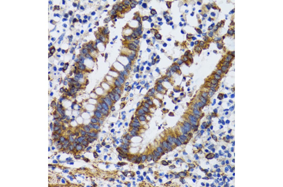 Immunohistochemistry - Anti-PGRMC1 Antibody (A14864) - Antibodies.com