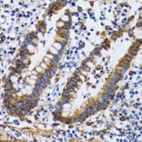 Immunohistochemistry - Anti-PGRMC1 Antibody (A14864) - Antibodies.com