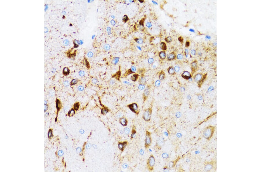 Immunohistochemistry - Anti-PGRMC1 Antibody (A14864) - Antibodies.com