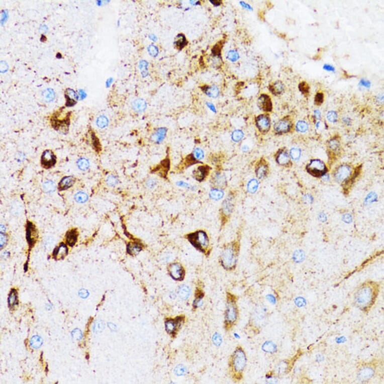 Immunohistochemistry - Anti-PGRMC1 Antibody (A14864) - Antibodies.com