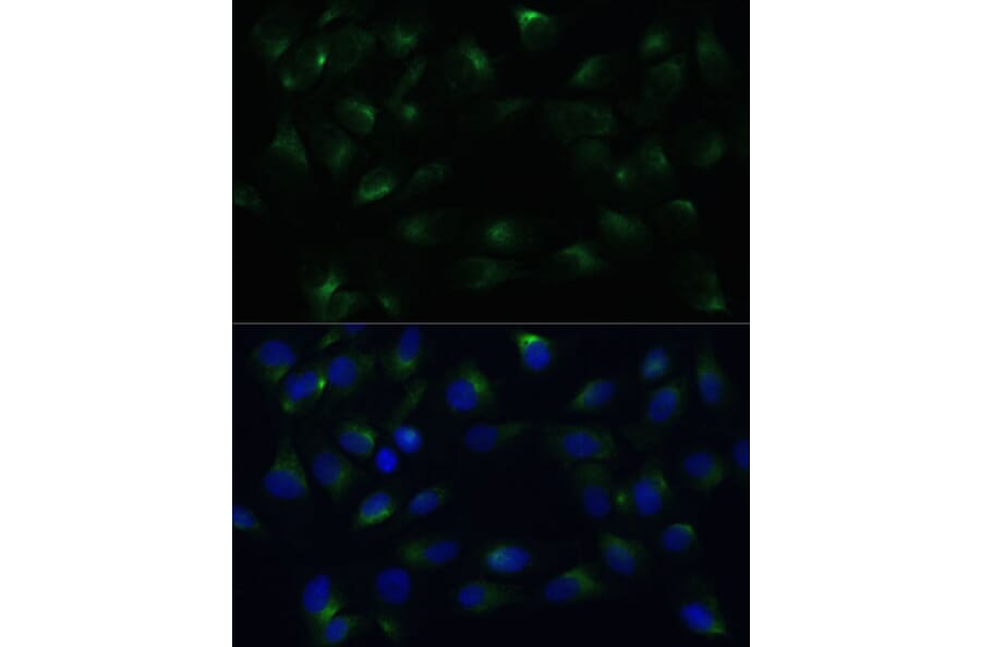 Immunofluorescence - Anti-PGRMC1 Antibody (A14864) - Antibodies.com