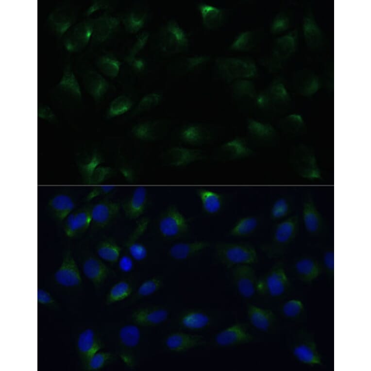 Immunofluorescence - Anti-PGRMC1 Antibody (A14864) - Antibodies.com