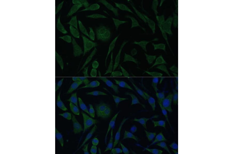 Immunofluorescence - Anti-PGRMC1 Antibody (A14864) - Antibodies.com