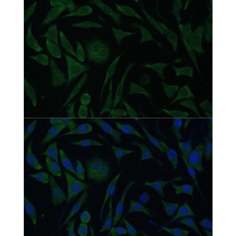 Immunofluorescence - Anti-PGRMC1 Antibody (A14864) - Antibodies.com