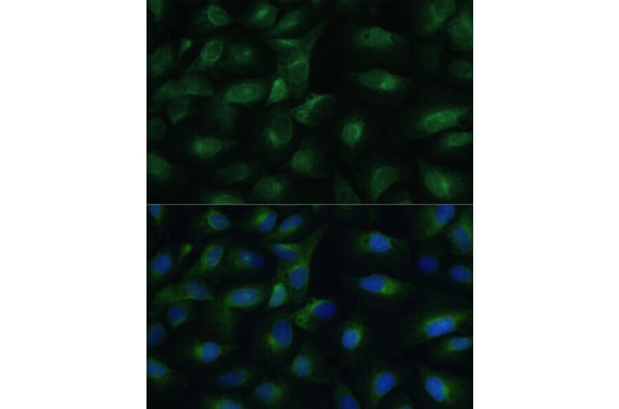 Immunofluorescence - Anti-PGRMC1 Antibody (A14864) - Antibodies.com