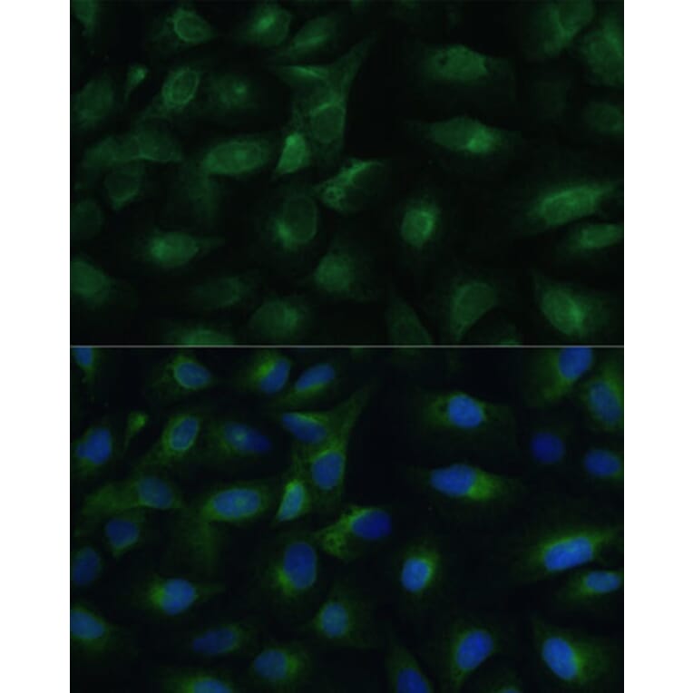 Immunofluorescence - Anti-PGRMC1 Antibody (A14864) - Antibodies.com