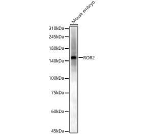 Western Blot - Anti-ROR2 Antibody (A14865) - Antibodies.com