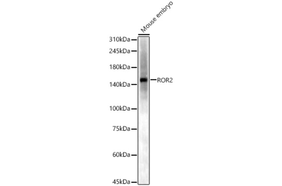 Western Blot - Anti-ROR2 Antibody (A14865) - Antibodies.com