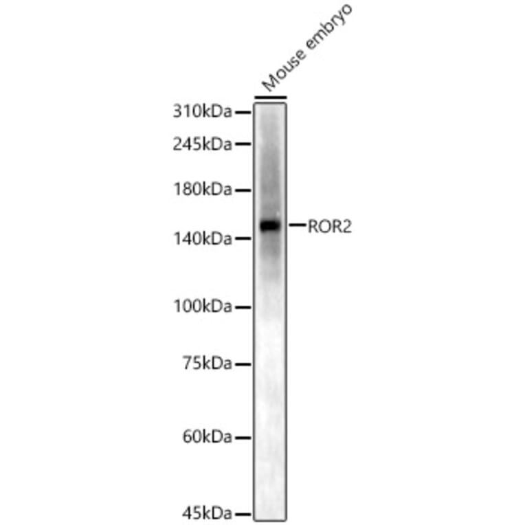 Western Blot - Anti-ROR2 Antibody (A14865) - Antibodies.com