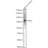 Western Blot - Anti-ROR2 Antibody (A14865) - Antibodies.com