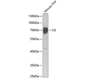 Western Blot - Anti-C9 Antibody (A14866) - Antibodies.com