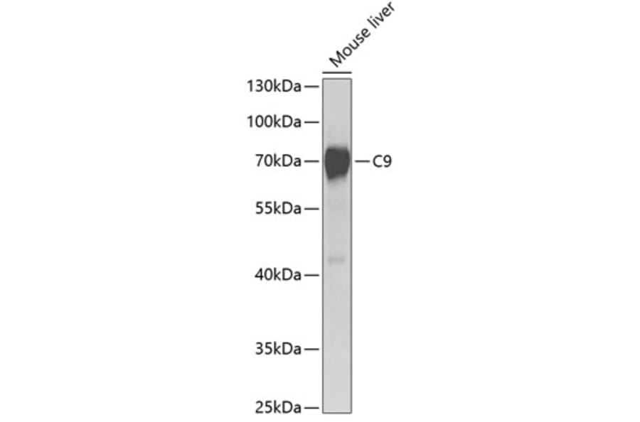 Western Blot - Anti-C9 Antibody (A14866) - Antibodies.com