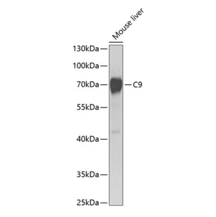 Western Blot - Anti-C9 Antibody (A14866) - Antibodies.com