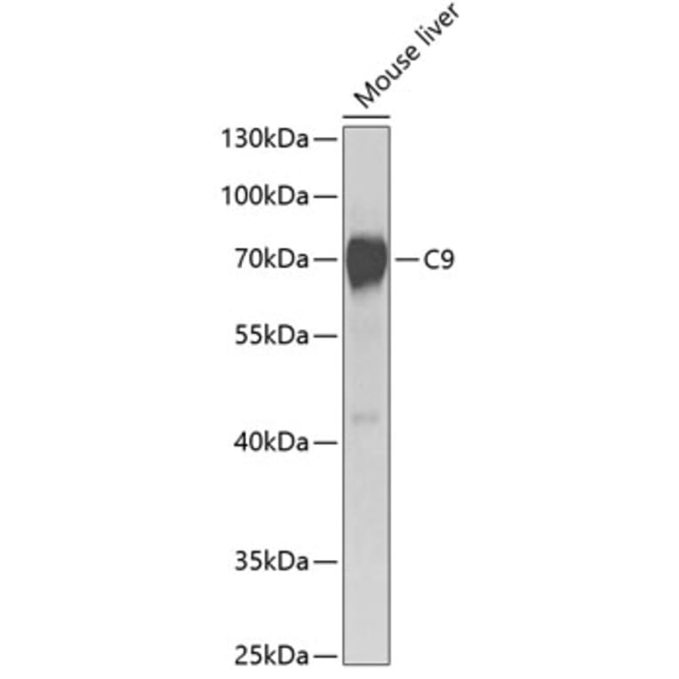 Western Blot - Anti-C9 Antibody (A14866) - Antibodies.com