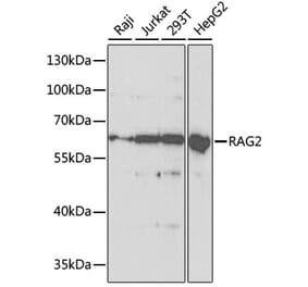 Western Blot - Anti-RAG2 Antibody (A14867) - Antibodies.com