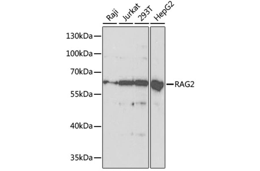 Western Blot - Anti-RAG2 Antibody (A14867) - Antibodies.com