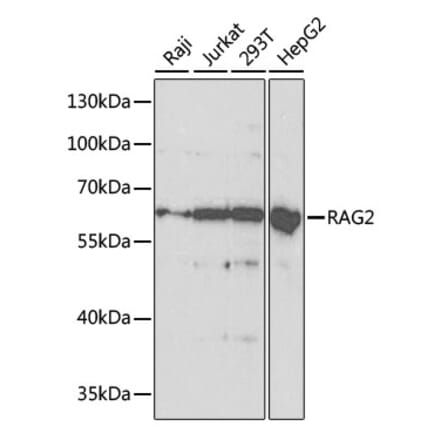 Western Blot - Anti-RAG2 Antibody (A14867) - Antibodies.com