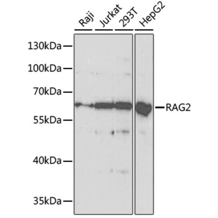 Western Blot - Anti-RAG2 Antibody (A14867) - Antibodies.com