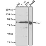 Western Blot - Anti-RAG2 Antibody (A14867) - Antibodies.com