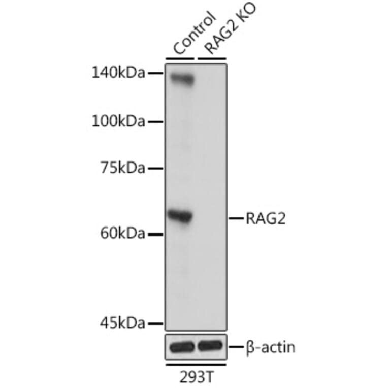 Western Blot - Anti-RAG2 Antibody (A14867) - Antibodies.com