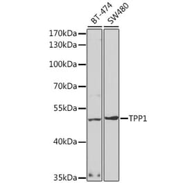 Western Blot - Anti-TPP1 Antibody (A14868) - Antibodies.com