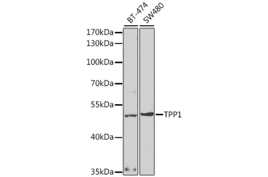 Western Blot - Anti-TPP1 Antibody (A14868) - Antibodies.com