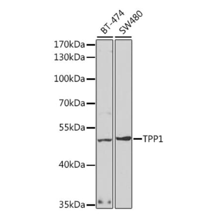 Western Blot - Anti-TPP1 Antibody (A14868) - Antibodies.com