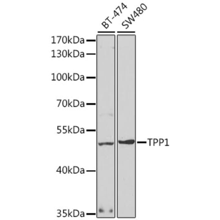 Western Blot - Anti-TPP1 Antibody (A14868) - Antibodies.com