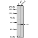 Western Blot - Anti-TPP1 Antibody (A14868) - Antibodies.com