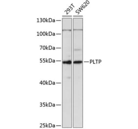 Western Blot - Anti-PLTP Antibody (A14869) - Antibodies.com