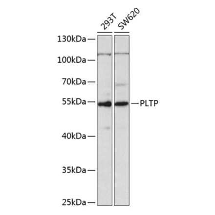 Western Blot - Anti-PLTP Antibody (A14869) - Antibodies.com