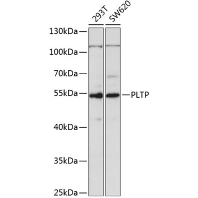 Western Blot - Anti-PLTP Antibody (A14869) - Antibodies.com