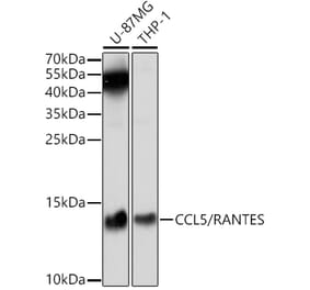 Western Blot - Anti-RANTES Antibody (A14870) - Antibodies.com