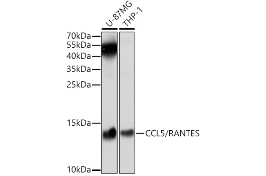 Western Blot - Anti-RANTES Antibody (A14870) - Antibodies.com