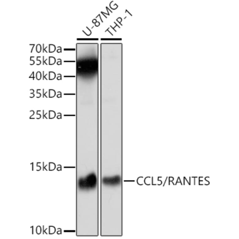 Western Blot - Anti-RANTES Antibody (A14870) - Antibodies.com