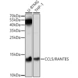 Western Blot - Anti-RANTES Antibody (A14870) - Antibodies.com