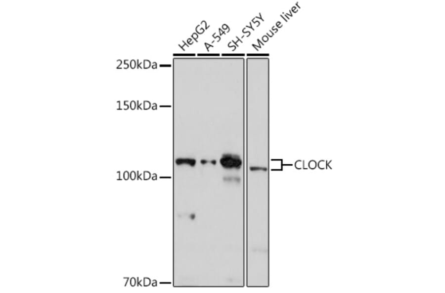 Western Blot - Anti-KAT13D/CLOCK Antibody (A14871) - Antibodies.com