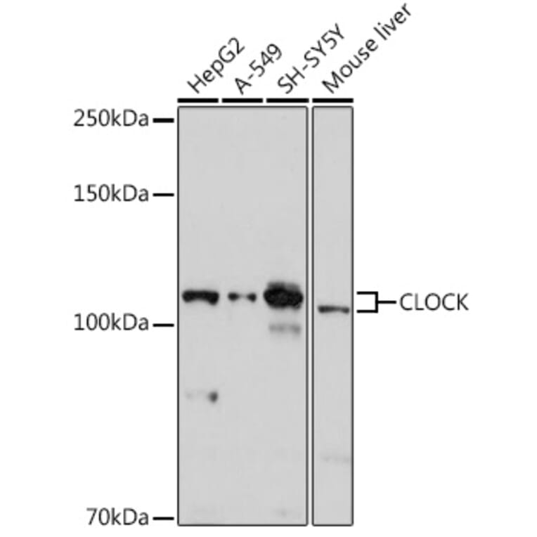 Western Blot - Anti-KAT13D/CLOCK Antibody (A14871) - Antibodies.com