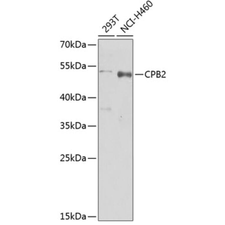 Western Blot - Anti-CPB2 Antibody (A5634) - Antibodies.com