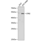 Western Blot - Anti-CPB2 Antibody (A5634) - Antibodies.com