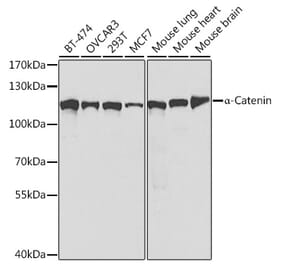 Western Blot - Anti-CTNNA1 Antibody (A14873) - Antibodies.com