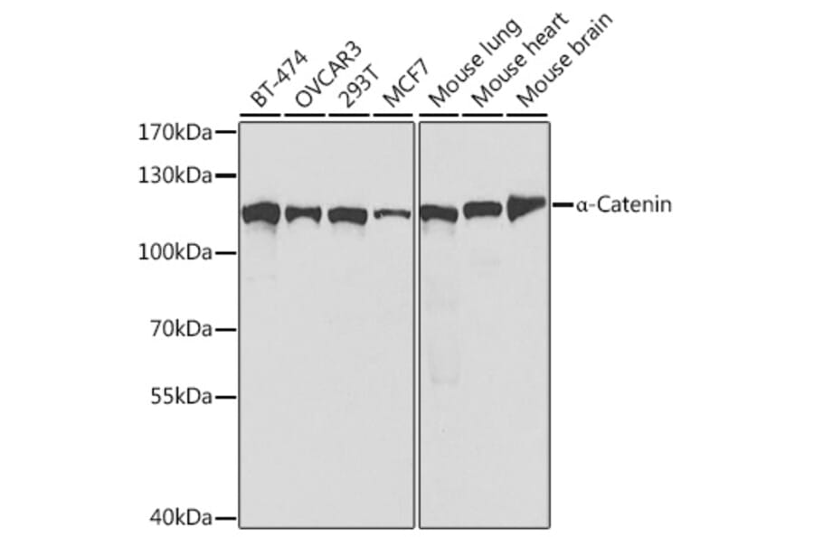 Western Blot - Anti-CTNNA1 Antibody (A14873) - Antibodies.com
