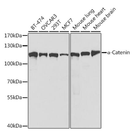 Western Blot - Anti-CTNNA1 Antibody (A14873) - Antibodies.com