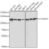 Western Blot - Anti-CTNNA1 Antibody (A14873) - Antibodies.com