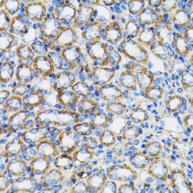 Immunohistochemistry - Anti-CTNNA1 Antibody (A14873) - Antibodies.com