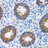 Immunohistochemistry - Anti-CTNNA1 Antibody (A14873) - Antibodies.com