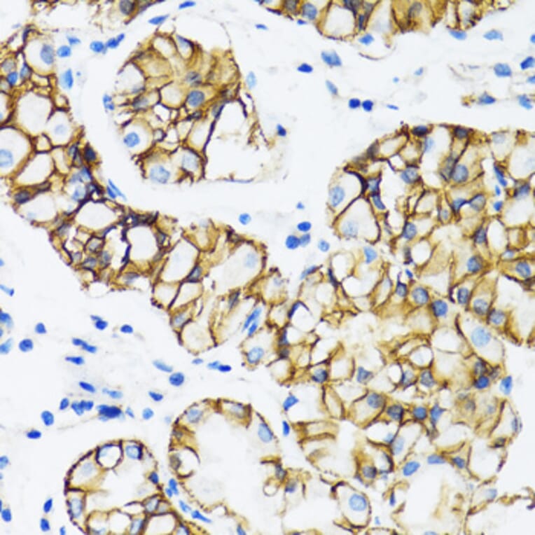 Immunohistochemistry - Anti-CTNNA1 Antibody (A14873) - Antibodies.com