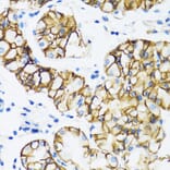 Immunohistochemistry - Anti-CTNNA1 Antibody (A14873) - Antibodies.com